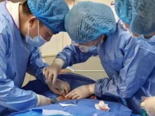 日照市中医医院实施首例腹壁输液泵植入术