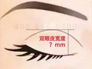 八大处整形宗宪磊：双眼皮埋线法的适应人群