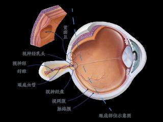 郑州尖峰眼科：高度近视能做手术吗