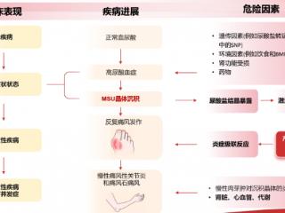 痛风创新药金蓓欣（伏欣奇拜单抗）不良反应知多少