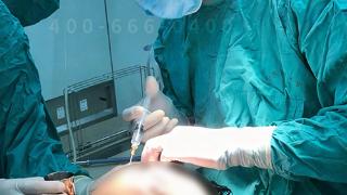 八大处整形赵延勇：改善鱼尾纹的几种方式，看你适合哪种？