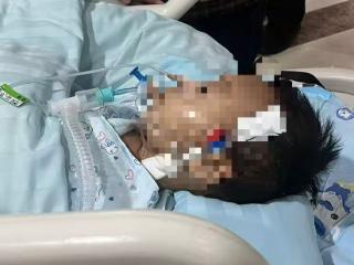 1岁8个月男童鼠药中毒最新进展：爱心涌向男童一家