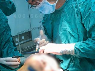 八大处整形赵延勇：拉皮术后回落是怎么回事？