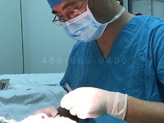 八大处整形赵延勇：早期祛眼袋，做内路即可