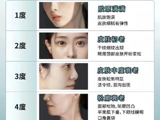 杏林除皱：哪些部位是衰老重灾区？五大衰老等级快来自测！