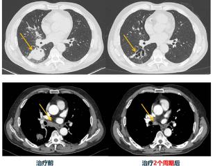 山东省肿瘤医院主任王海永：多学科协作、个体化诊疗是罕见肿瘤治疗的可行出路
