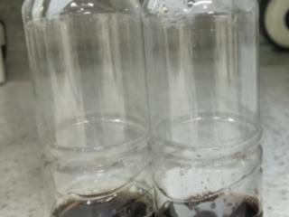 儿童反复发热伴尿色异常 青岛市妇女儿童医院提醒警惕溶血性贫血