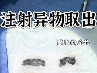 北京煤医西坝河周云超：奥美定能取干净吗？