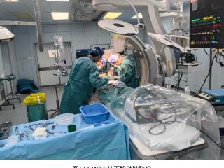 国际首例！齐鲁医院完成首例经ECMO腋动脉导管行冠脉介入治疗