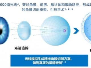 高考结束摘镜忙：贵港学子为圆军警梦 理性选择近视矫正方案