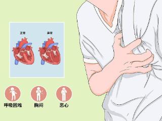 端午守护“心”健康！射阳县人民医院心血管内科成功开展两项心脏介入治疗新技术