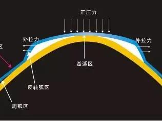 晚上戴、白天清——OK镜到底是靠什么“压”住近视的？