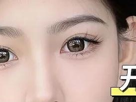 杏林眼综合：开扇VS平扇，哪一种才是适配度更高的双眼皮形态？